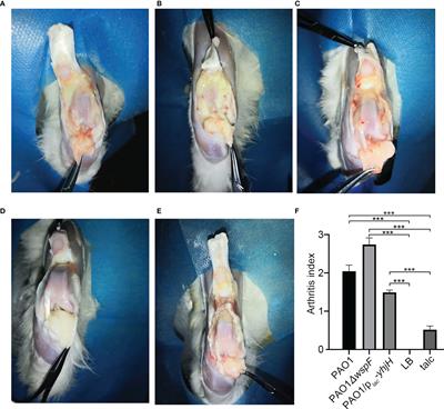 Biofilm Formation by Pseudomonas aeruginosa in a Novel Septic Arthritis Model
